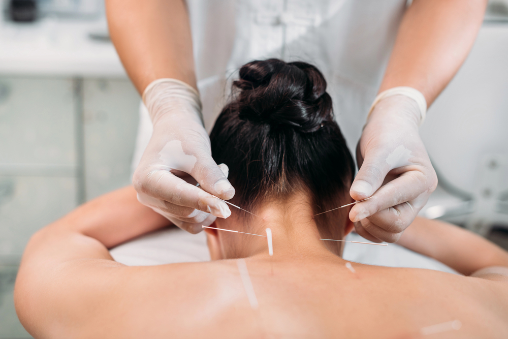 acupuntura en cuello